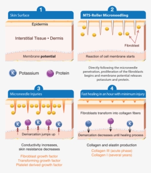 The Downtime Required Of Various Skin Therapies Depends - Skin