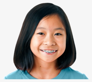 Girl-braces - Girl Braces Transparent Png