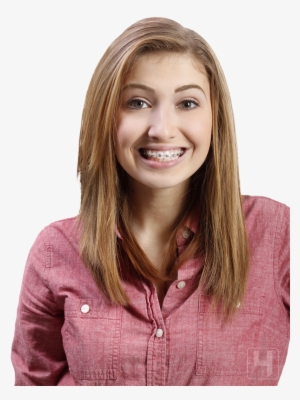Key Benefits Of Self Ligating Braces - Girl With Brackets Png