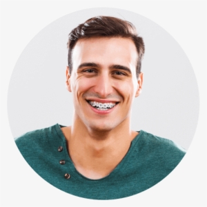 Metal Braces - Adult Braces