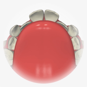 Modern Research Has Shown That Crowded Teeth, Incorrect - Orthodontics