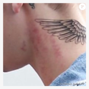 Justin Bieber Et Ses Rougeurs, Décembre - Justin Bieber Tattoo Ense