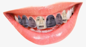 “buck Teethi'm So Sorry ” - Human Tooth