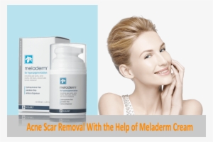 Acne Scar Removal With The Help Of Meladerm Cream Topskinlighteningcreams - Meladerm Cream