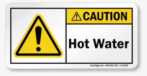 Zoom - Buy - Caution Equipment Starts Automatically