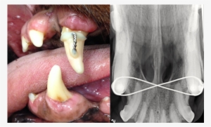 Left To Right - Human Tooth