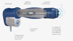 Is Broken As A Result Of Shock Wave Therapy And The - Does Shock Wave Therapy Work