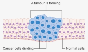 Cells - Cancer Cells Diagram