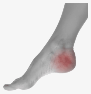 Choose The Most Trusted Podiatrist Doctor In The Area - Pain In Foot Png
