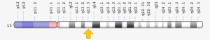 Inherited Microdeletions Or Microduplications A Benign - Scn11a Gene