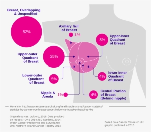 Open - Breast Cancer Overlapping Sites