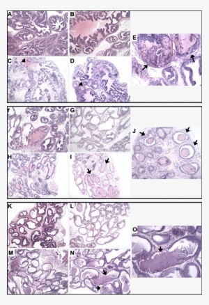 Comparison Of Prostate Lobe Ap , Dlp (f J), And Vp - Dihydrotestosterone