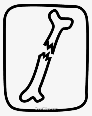 Broken Bone Royalty Free Vector Clip Art Illustration - Broken Bone Clip Art