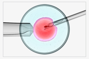Deepam Fertility Centre Is Functioning As A Separate - Ivf