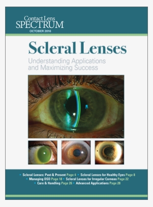 This Special Editorial Supplement Serves As An Introduction - Scleral Lens