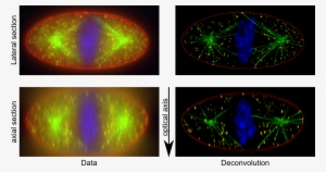 Http - //cral - Univ-lyon1 - Fr/labo/perso/ferreol - Deconvolution Fluorescence Microscopy