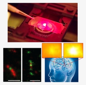 2018 Infrared Fluorescence Microscopy And Nanosensors - Nanosensor For Brain