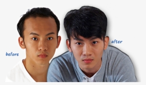 Aremy Hair Salon Is Very Customer Focus Both In Terms - Male Hair Loss Singapore