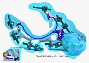 I Am Still Working On A Functioning Prosthetic Design - Illustration