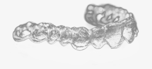 Advantages Of Phasing System - Zahnarztpraxis Andreas Porter