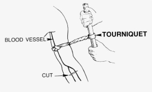 Tourniquet