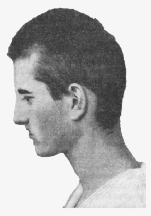 Asthenic Schizophrenic, Age 21 - Gentleman