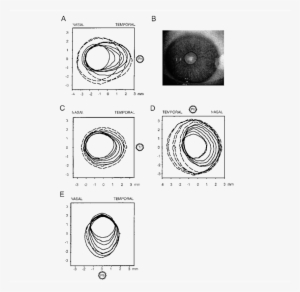 Pupil Dilation Following Focal Drug Application - Circle