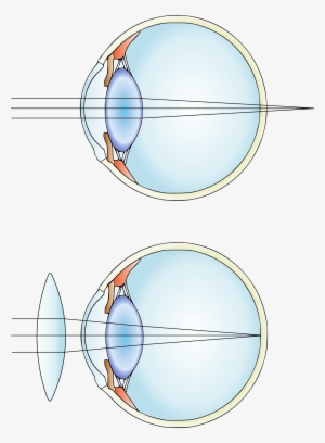 Far-sightedness