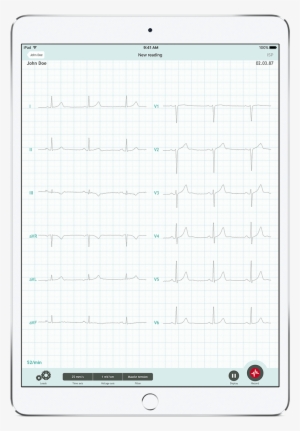 Cardiosecur Pro 12 Leads - Paper