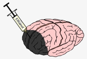 Symbolic Effect Of Brain Damaged By Too Much Alcohol - Brain And Alcohol Png