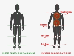 Back Pain - Illustration