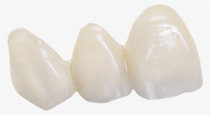 Bruxzir Anterior Teeth - Brassiere