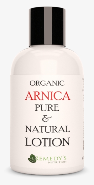 Discoloration, Swelling And Pain From Bruises This - Christmas Day