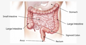 Large Intestine - Colon Cancer