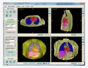 The Rendered Anatomy Are The Lungs , Heart (red), Liver - Rendering