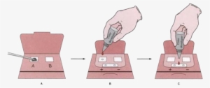 Fecal Occult Blood Test - Guaiac Test Steps