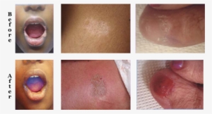 Fees Based At Hourly Rate And Will Be Determined At - Scar Blending