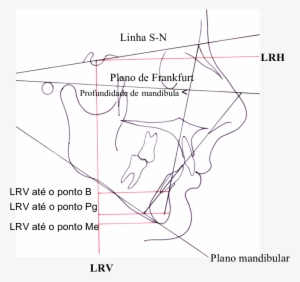 Linhas De Referência Vertical Lrv E Horizontal Lrh, - Diagram