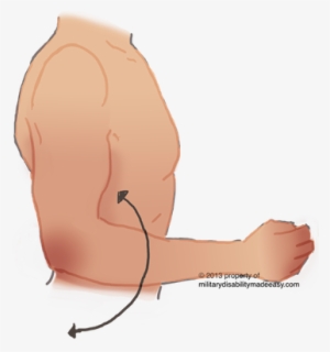 Upper Nerve 15 - Illustration