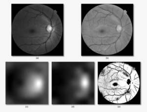 Background Removal By Foracchia Et Al - 2011