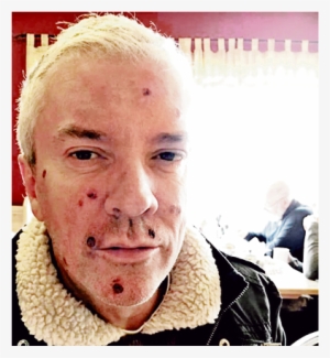 Telly Star Justin Ryan Reveals Shock Cancer Scare After - Colin Justin 60 Minute Makeover