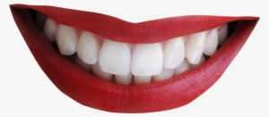 Smiling Lips Png - Cara Alami Buat Gigi Tidak Maju