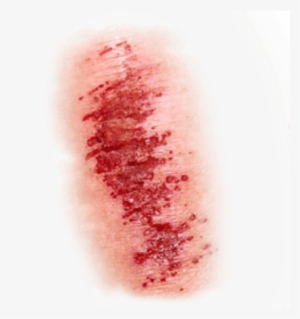 Light Wound - Wound Png