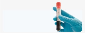 My Pet Is Having A Blood Test - Blood Sample Png