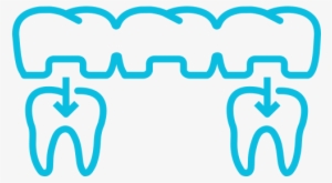 Bridges - Dental Bridge Icon Png