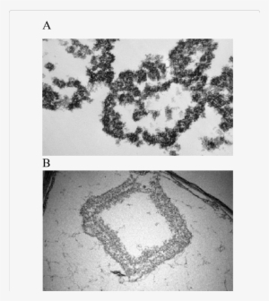 A) Cmv Viral Nanoparticles Appears In Geometric Rows - Crystal