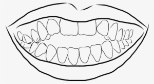 Invisalign® - Outline Of An Open Mouth Showing Teeth