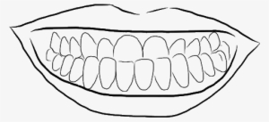 Underbite - Kevin B. Sands, Dds