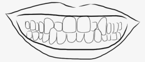 Crossbite - Line Art