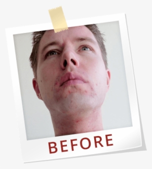 Paul Jaminet Ph - Logan Paul With Pimples